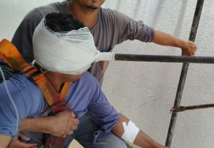 Imagem do dia: Pedreiro tem rosto cravado com barra de ferro durante acidente em obra