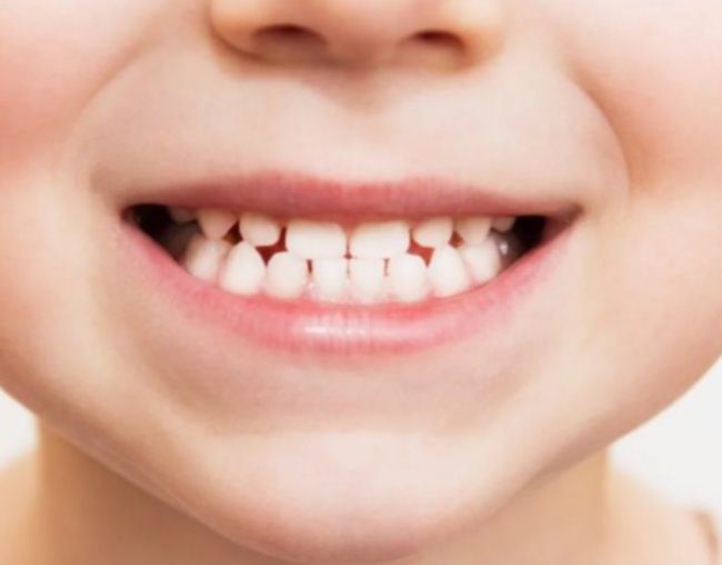 Artigo – Prevenção odontológica em oncologia pediátrica